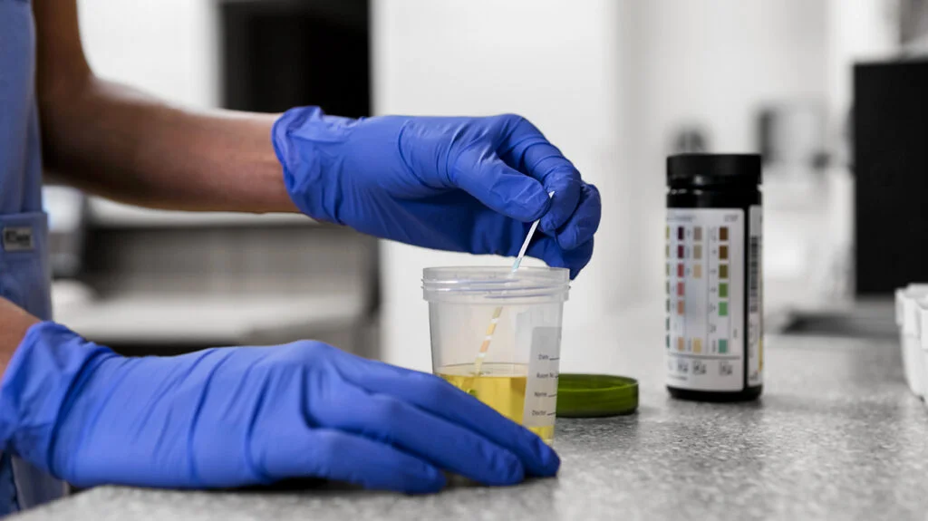 how long does fentanyl stay in your urine, fentanyl urine drug test