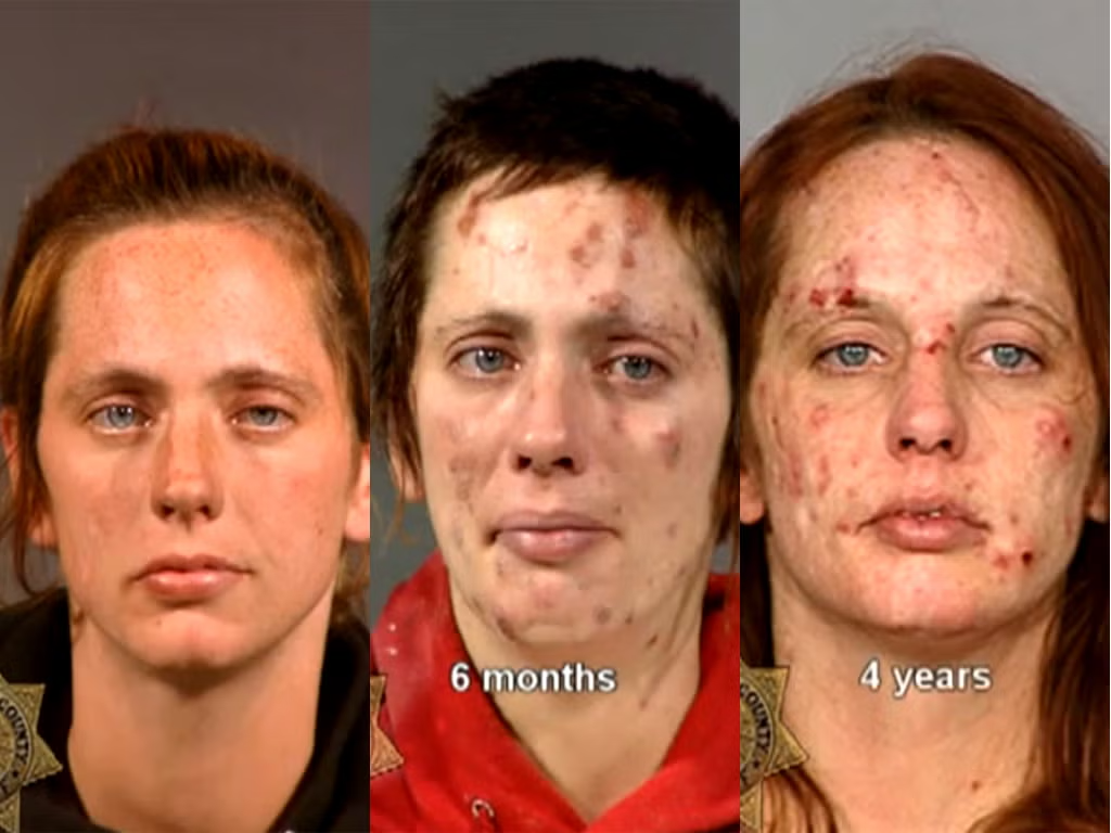 real meth addict mugshots